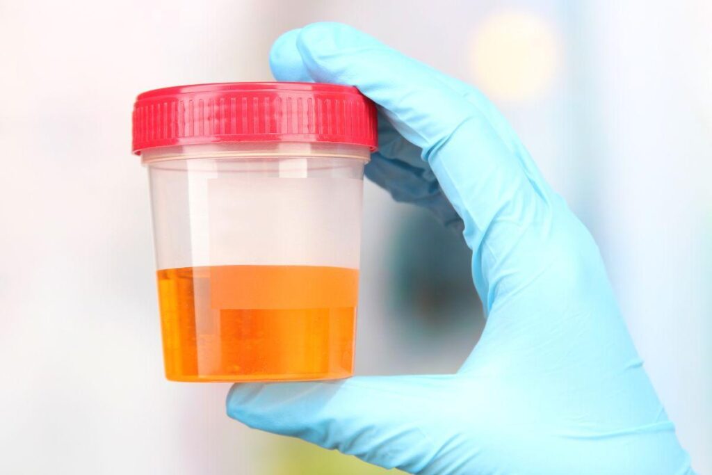 Urina com sangue: entenda os riscos e saiba como agir